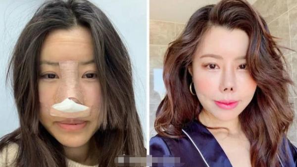 10位“整容過度”的女星：舒暢張檬畫蛇添足，黃夏惠變“鞋拔臉”