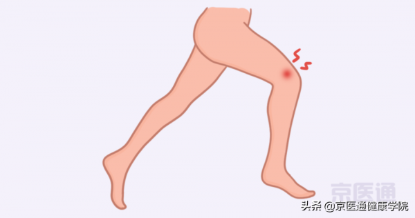 膝蓋疼、腿疼、腳疼,5種跑步損傷,專家教你處理 膝蓋疼、腿疼、腳疼,5種跑步損傷,專家教你處理