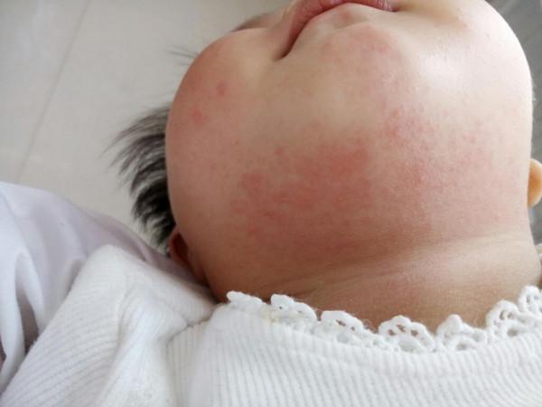 一歲前的寶寶老是抓耳朵,啥原因怎麼護理?媽媽要心中有數 一歲前的寶寶老是抓耳朵,啥原因怎麼護理?媽媽要心中有數