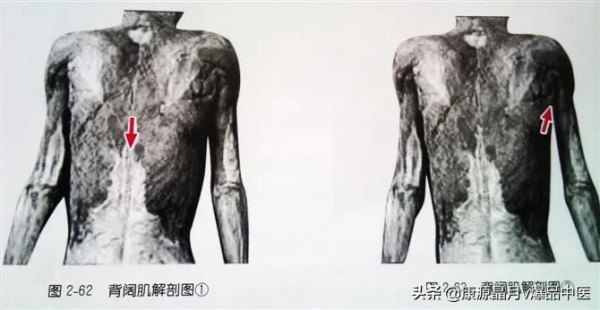 肩部疼痛的觸診圖解（很珍貴資料），值得一看