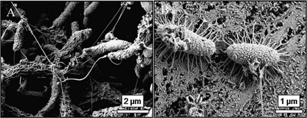 小小的微生物,正在吃掉我們的“GDP” 小小的微生物,正在吃掉我們的“GDP”
