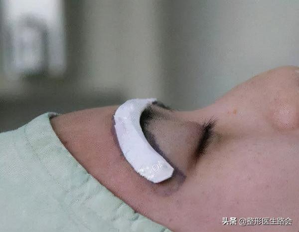 眉弓——讓你變“混血”的點睛之筆? 眉弓——讓你變“混血”的點睛之筆?