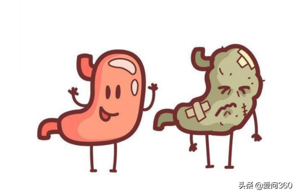 有這些表現可能是胃癌症狀，多數是這幾類原因造成的，如何預防？