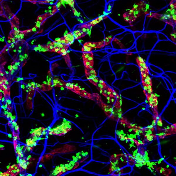 有證據了!人體免疫系統清晨功能最強 有證據了!人體免疫系統清晨功能最強