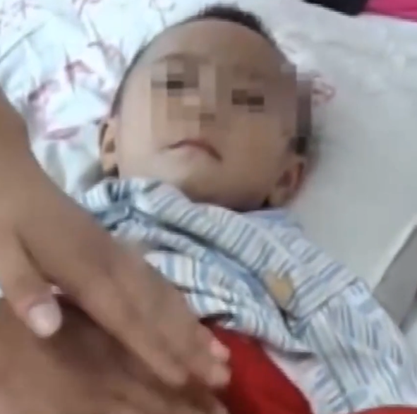 真實故事：陝西1歲幼童患怪病，身體長出鐵釘，醫生查明真相
