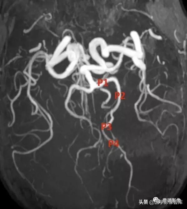 CT斷層解剖圖譜最全總結「推薦收藏」 CT斷層解剖圖譜最全總結「推薦收藏」