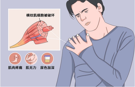 長期口服阿司匹林腸溶片和阿託伐他汀鈣會怎樣？有何注意事項？