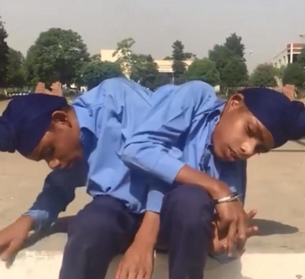 印度連體雙胞胎剛出生就被遺棄，如今一起找到工作，拿雙份工資