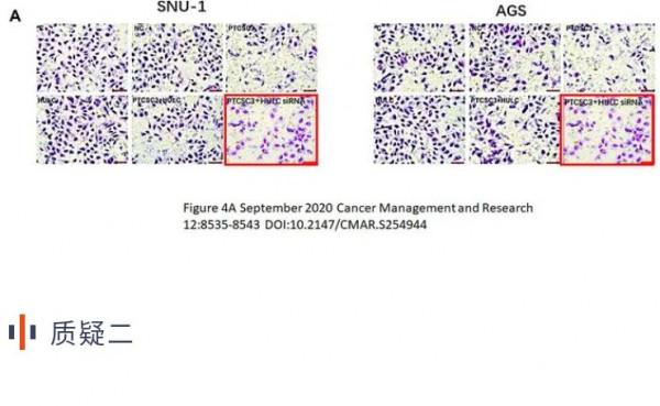 安徽醫科大學第一附屬醫院發表的論文因細胞圖片重複被撤回 安徽醫科大學第一附屬醫院發表的論文因細胞圖片重複被撤回