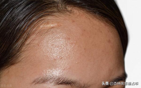簡單一味解除脾虛溼盛的中藥，利水滲溼，健脾止瀉，讓你身輕有力