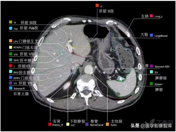 CT斷層解剖圖譜最全總結「推薦收藏」 CT斷層解剖圖譜最全總結「推薦收藏」