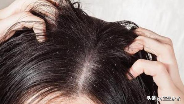頭髮要隔多長時間洗一次才好？看完一解你心頭之惑