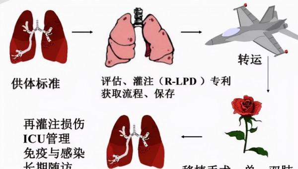 器官捐獻:肝臟26萬,腎臟16萬,心臟10萬!哪些疾病能移植? 器官捐獻:肝臟26萬,腎臟16萬,心臟10萬!哪些疾病能移植?
