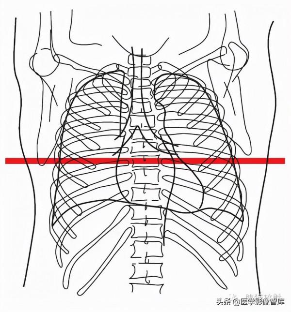 CT斷層解剖圖譜最全總結「推薦收藏」 CT斷層解剖圖譜最全總結「推薦收藏」