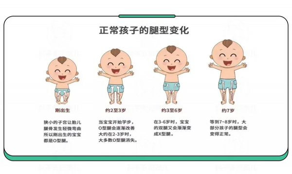 1歲娃學走路摔成腦損傷!學步期,這4種姿勢很危險 1歲娃學走路摔成腦損傷!學步期,這4種姿勢很危險