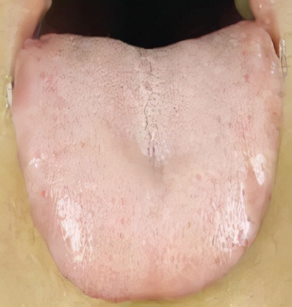 血虛體質有哪些表現？應該如何調養？