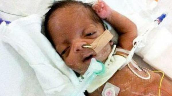 英國男子臉部畸形，憑魅力迎娶美女大學生，孩子出生後笑不出來了