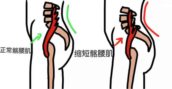 睡覺時腰部懸空、酸脹？兩招幫你緩解