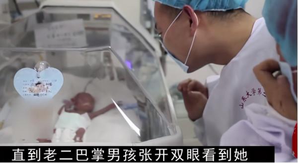 山東一位高齡孕婦冒死生下五胞胎，最小的嬰兒竟只有雞蛋那麼大