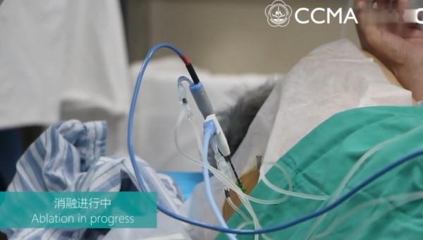 肺小結節處理的常見誤區，千萬小心