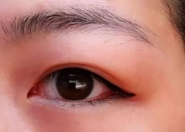 陽氣不足的人，身體有2處明顯特徵，肉眼可見，應對也很簡單