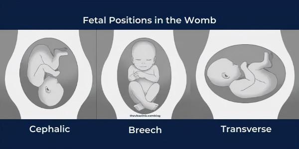 慘的不只有早產，還有麻醉過早失效的剖腹產