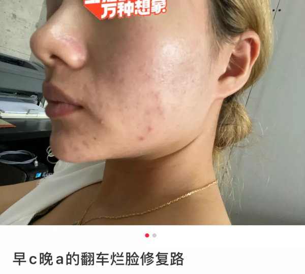 網紅“沉浸式護膚”,毀了多少中國女孩? 網紅“沉浸式護膚”,毀了多少中國女孩?