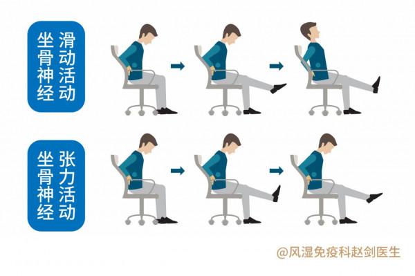 腰椎間盤突出要少運動？不宜跑步和健步走？醫生：正確運動康復快