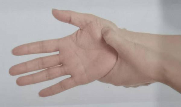 1個穴位對症3個反射區；幫你清肺理氣