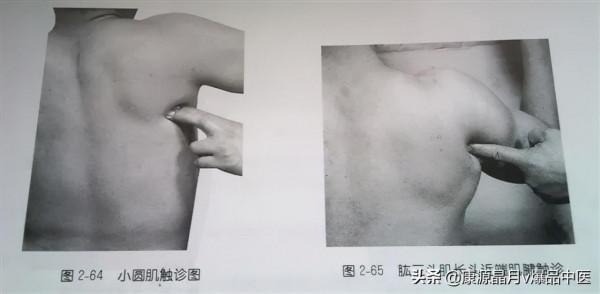 肩部疼痛的觸診圖解（很珍貴資料），值得一看
