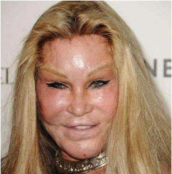 整容富婆“貓女”：離婚獲得25億美元，如今僅靠900美元維持生活