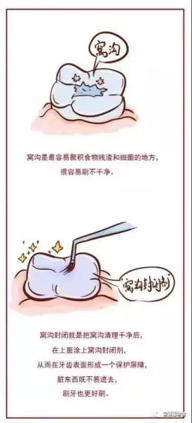 6-12歲換牙時間和換牙期問題大盤點！孩子一口好牙關鍵就在這幾點