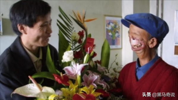 3歲被狼咬掉半張臉，靠吸米糊存活的寇金成，有著怎樣曲折的人生