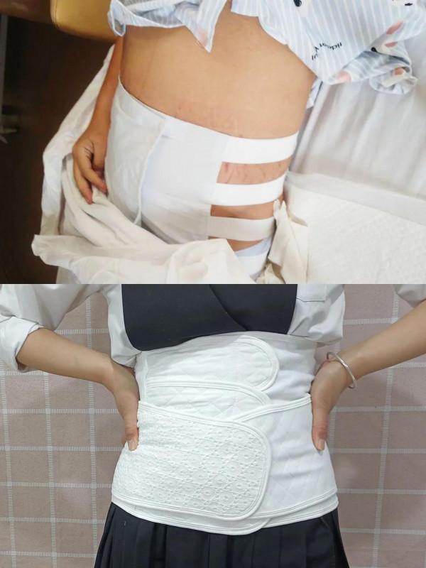 剖腹產一定需要收腹帶?說說我的感受 剖腹產一定需要收腹帶?說說我的感受