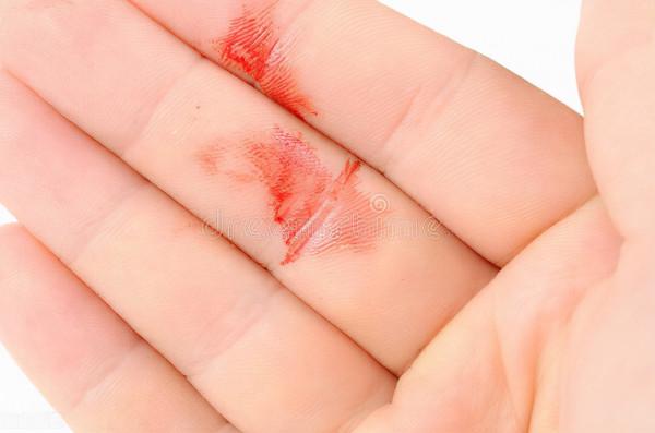 腫瘤是如何一步一步打垮身體的？只需4步，希望你注意了