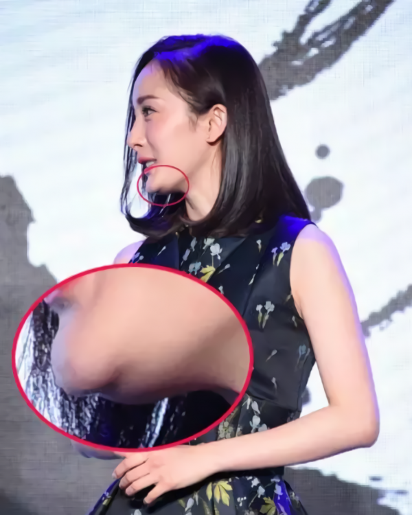 那些“一刀切”削臉的明星還好嗎？有的已垮掉，小方臉成最後贏家