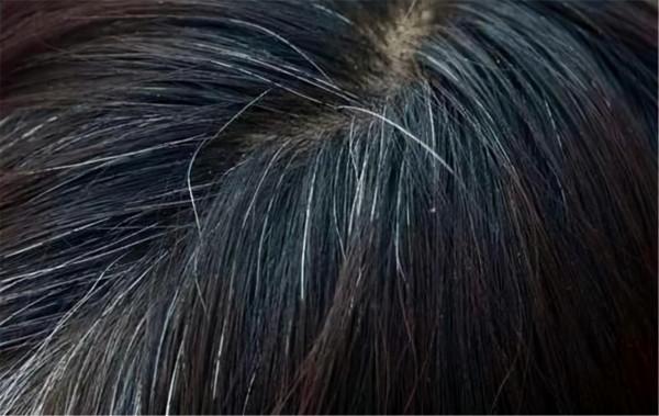 洗頭時加幾粒&OpenCurlyDoubleQuote;阿司匹林&rdquo;，堅持4個月後，頭髮會發生什麼變化？