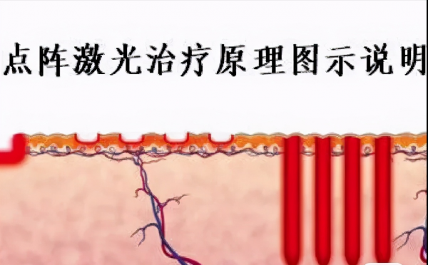 入門級醫美專案指南!美容院不告訴你的,這篇全都有 入門級醫美專案指南!美容院不告訴你的,這篇全都有