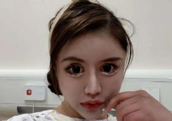 “真人芭比”周楚娜：2年半歷經100多次手術，一張臉抵一輛跑車