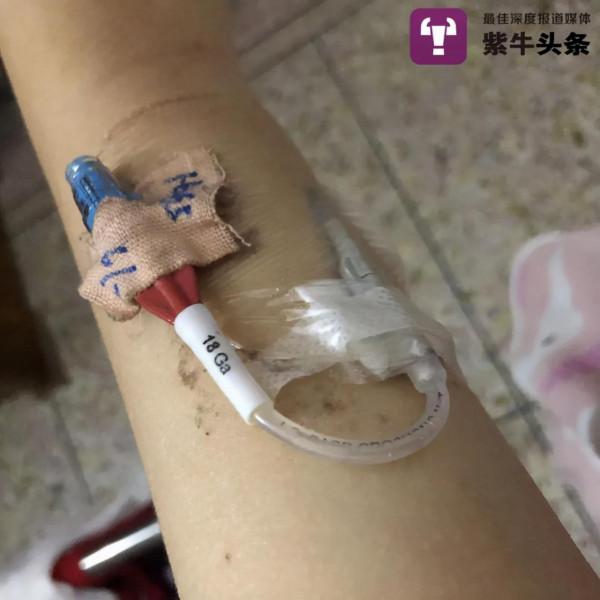 24歲女生抗癌一年：做3次化療30多次放療 脖子潰爛