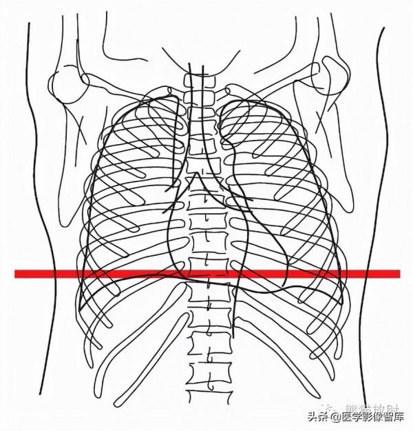 CT斷層解剖圖譜最全總結「推薦收藏」 CT斷層解剖圖譜最全總結「推薦收藏」