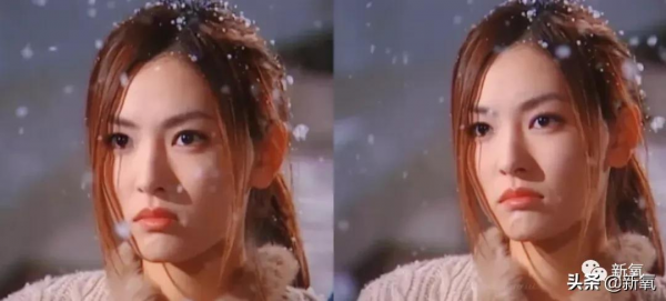 嘴角下垂對面容的影響有多大？