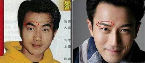 娛樂圈男星換臉大比拼：有人削骨，有人隆鼻，有人直接“換頭”