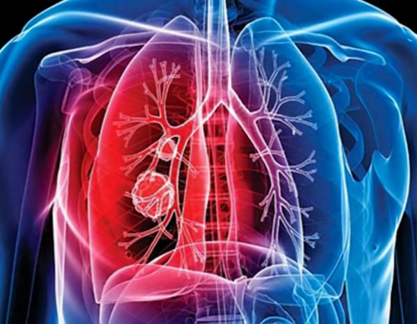 喉嚨有痰,咳不出,咽不下,可能是這3種疾病造成的 喉嚨有痰,咳不出,咽不下,可能是這3種疾病造成的