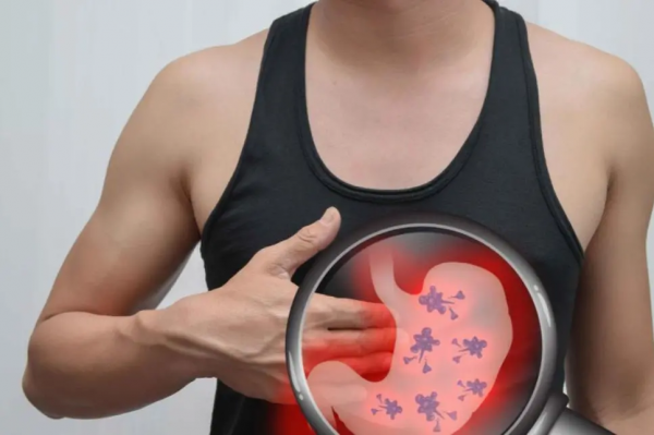 胃部息肉，不可不重視！小心是胃腺瘤先兆