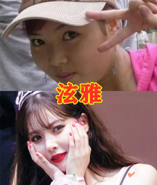 “曾經嫌他醜，如今變顏狗”看下娛樂圈內的明星變化有多大