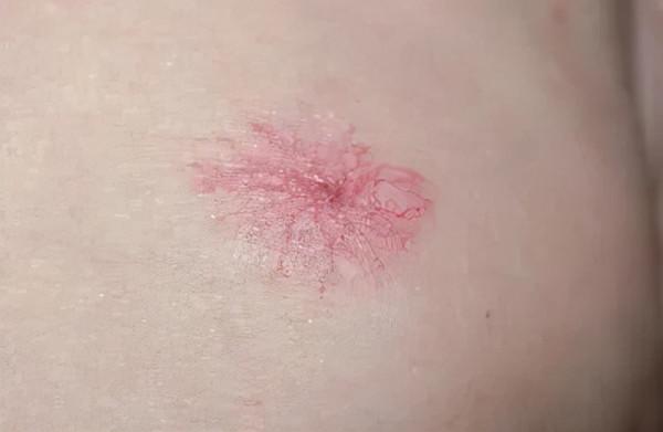 體內有病，“面相”先知？醫生提醒：若出現4種症狀，最好去查下