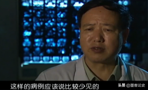 江西8歲女孩患血管瘤，下巴長出長舌狀肉瘤，隨年齡增長垂吊胸前