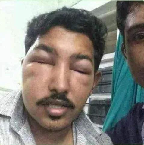 這個世界上論開掛，我只服阿三，死亡率全球第一！果然夠奇葩