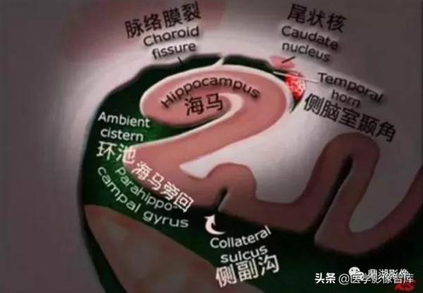 海馬解剖及影像學評估 海馬解剖及影像學評估